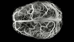 descubren-una-enfermedad-ultrarrara-con-solo-13-casos-en-el-mundo