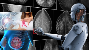 inteligencia-artificial-mejora-deteccion-temprana-del-cancer-de-mama