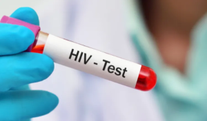 panama-oficializa-plan-nacional-contra-el-vih-con-meta-de-frenar-la-epidemia-al-2030