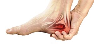 Talalgia: por qué duele el talón y cómo aliviarlo
