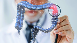 Antecedentes familiares y genética duplican el riesgo de cáncer de colon