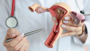 Identifican indicador clave que anticipa la recaída en el cáncer de endometrio más frecuente