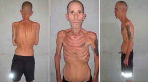 Las impactantes imágenes de un preso político cubano al salir de prisión luego de cinco años tras las rejas