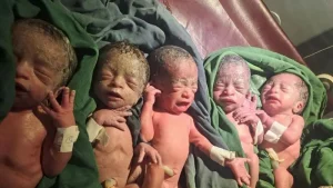 mujer-da-a-luz-a-quintillizos-en-etiopia-tras-12-anos-intentando-concebir