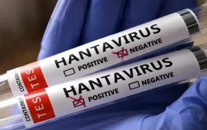 Autoridades sanitarias de EEUU ven «muy bajo» el riesgo del hantavirus para la población