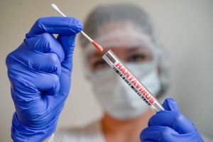 Hantavirus puede ser más contagioso al inicio de la enfermedad, advierte OMS