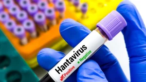 La mortalidad por hantavirus alcanza el 50% entre adolescentes