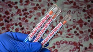 crisis-de-hantavirus:-11-casos-y-bajo-riesgo-segun-la-oms