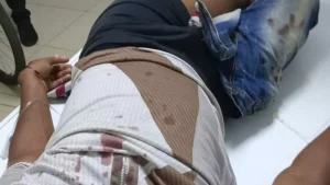 buscan-conductor-que-atropello-a-menor-y-huyo-tras-accidente-en-via-publica