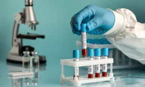 desarrollan-prueba-rapida-que-detecta-cancer-de-pancreas-en-minutos-mediante-una-muestra-de-sangre
