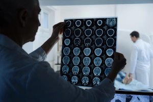 especialista-advierte-que-tumores-cerebrales-benignos-tambien-pueden-poner-en-riesgo-la-salud