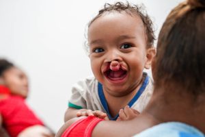 Fundación Operación Sonrisa República Dominicana convoca a pacientes para cirugías gratuitas de labio y paladar hendido