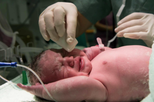 Parto vaginal o cesárea: ¿qué opción es más segura para madre y bebé?
