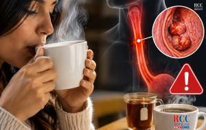 Bebidas muy calientes aumentan el riesgo de cáncer de esófago, según estudio