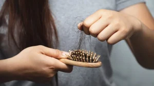 estas-senales-pueden-indicar-que-la-caida-del-cabello-requiere-atencion-medica